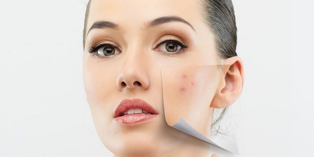 Living with Skin Disease