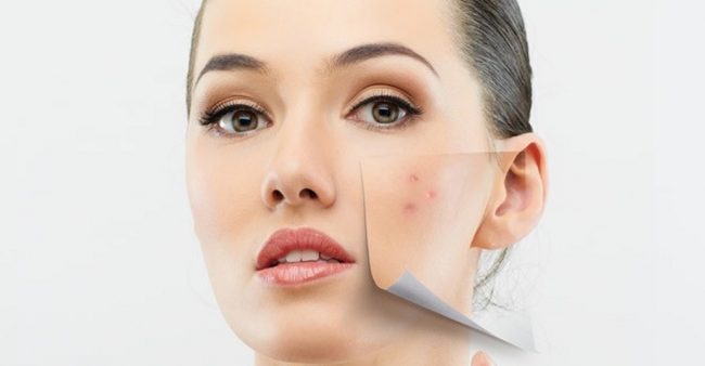 img7368236 Living with Skin Disease